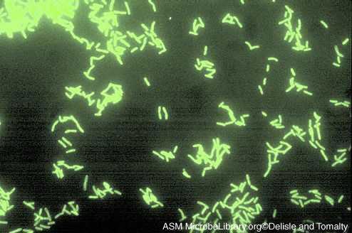 Indirect Fluorescent Antibody Test Indirect Fluorescent Antibody Test Rickettsia