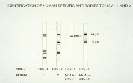 4. Western Immunoblot Confirmatory tests detecting specific antibodies according to their molecular weight (MW). Procedure: 1.