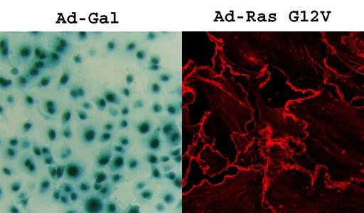 Figure 2: Membrane Ruffling Induced by Activated H-Ras. COS-7 cells were infected with purified Ad-β Gal or Ras G12V at 50 MOI (multiplicity of infection).