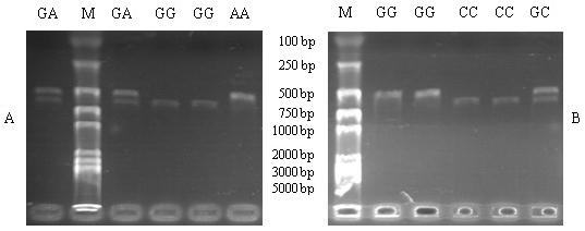 SNP in the CCNA2 gene associated with wool density in rabbits 3369 Figure 2. PCR-RFLP results. A. Agarose gel electrophoresis of ScaI PCR-RFLP.
