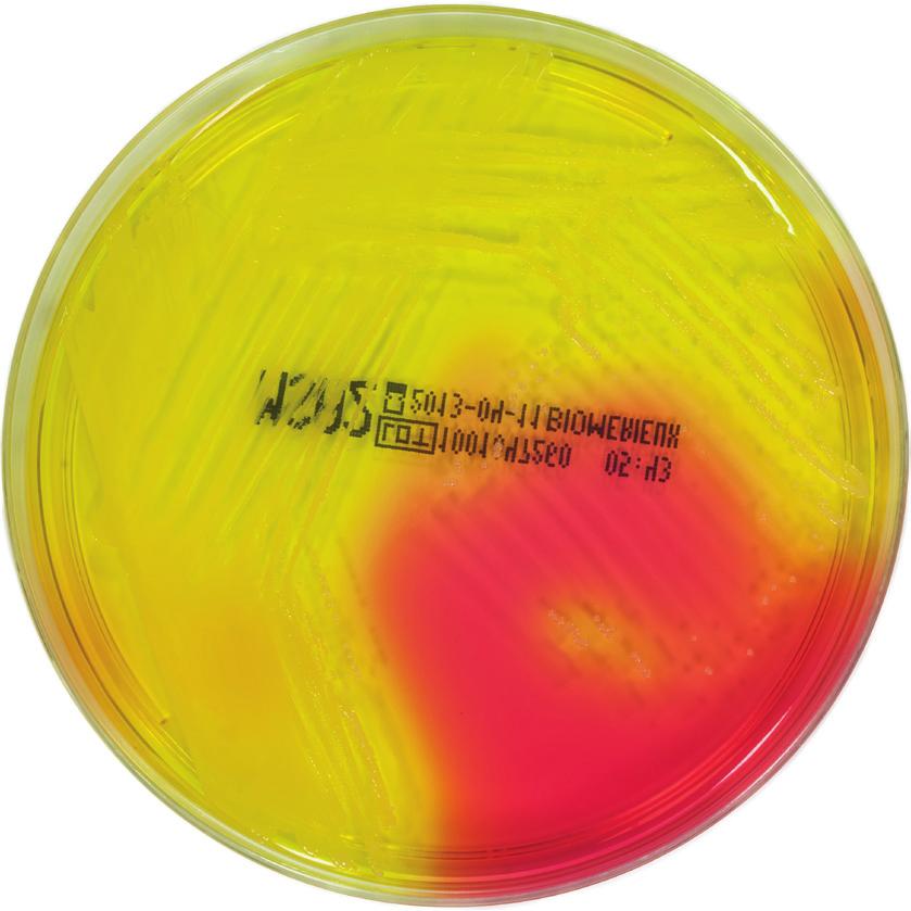 Unit 2: Industrial Microbiology Figure 2.4.1: S. aureus growing on Mannitol salt agar (left) and producing the characteristic yellow colour.
