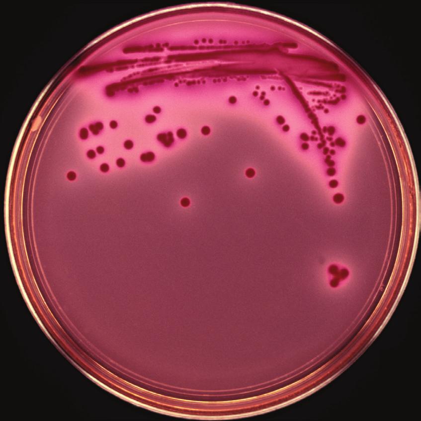 Coliforms are lactose fermenters, E. coli more so than others. The medium around their growth (colonies) becomes red (see Figure 2.4.2 (a)).