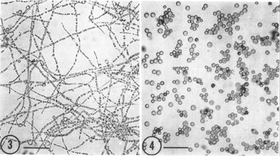 Control of dimorphism by glucose concentration. Liquid cultures under 30% CO2. (left) Hyphae in 0,01% glucose; (right) yeast cells in 1% glucose. Incubation time was 24 hr.