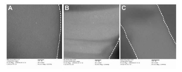 Figure 2.3. Transmission electron micrographs of OsO 4 stained and sectioned electrospun collagen fibers crosslinked using A) DHT, B) EDC, and C) DHT+EDC. Control scaffolds degraded during processing.