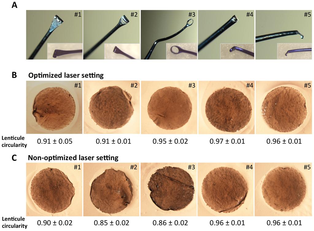 New Instruments for Lenticule Extraction in SMILE Figure 1. The pictures of the extracted lenticules and the mean lenticule circularity for different instruments.