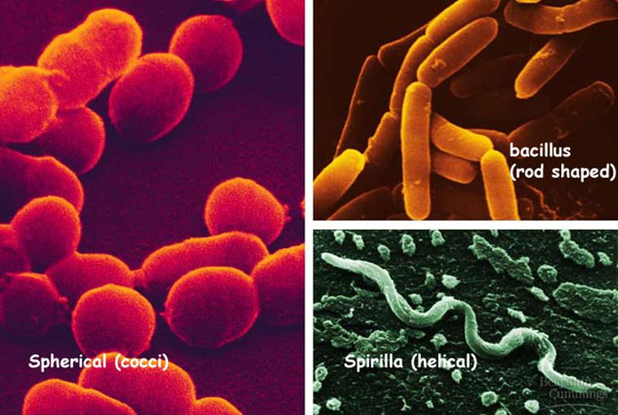 21 Bacteria Bacterial Types They are classified according to three shapes Round (cocci) e.g. Pneumonia Rod (bacillus) e.
