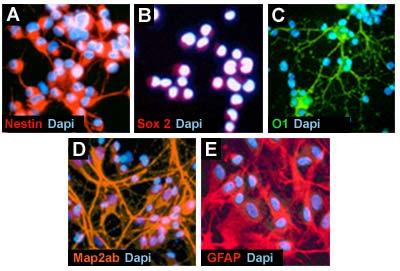 Immunofluorescent Images of Antibody Components in Neural Stem Cell Characterization Kit (SCR019) Cultured adult rat hippocampus-derived neural stem cells stained for (A) Nestin (red) and (B) Sox-2