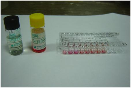 krusei Pink (dry) [Table/Fig-3]: Speciation of Candida isolates using Tetrazolium reduction medium [Table/Fig-5]: Identification of different Candida species by CHROMagar (Paris, France) S.