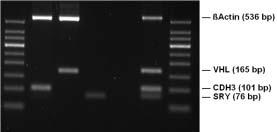 Appendix A: Specificity and Reliability To confirm PCR specificity and reliability when using the EpiTect PCR Control DNA set, a 4-plex PCR was performed.