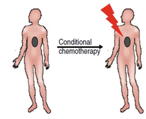 Chimeric Antigen Receptor T-Cell Therapy Autologous CAR Therapy