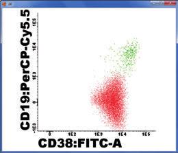 Normal PC Pathological PC CD19 + (96%) CD56 + (67%) CD45 ++ + / ++ (45%) CD38 +++ ++ (100%) Pérez-Andrés et al.