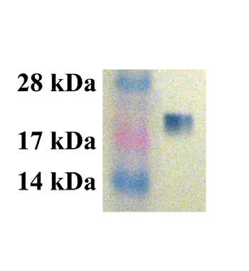 Figure 5: Rac1 Activation Assay. Lane 1: MW Standard. Lane 2: 293 cell lysate loaded with GDP and incubated with PAK PBD Agarose beads.