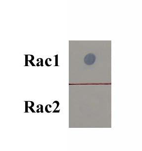 Lane 3: MDA-231 cell lysate loaded with GTPγS and incubated with Rhotekin RBD Agarose beads.