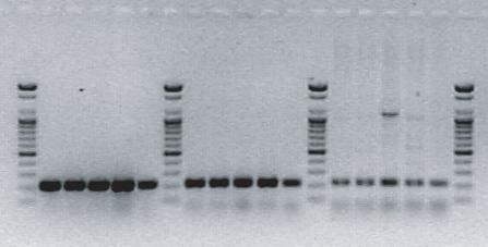 Comparative Test of Products PCR est T from Hela cdna Library M 2 3 4 5 M PCR est T from Fungi Genomic DNA M 2 3 4 5 6 M M: Kb