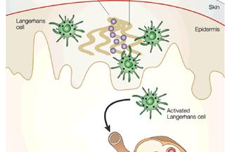 of a Th1 immune response