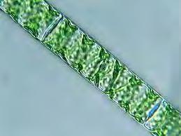 bacteria Toxic to Animals and Humans Most Famous Blue Green is Lyngbia Some
