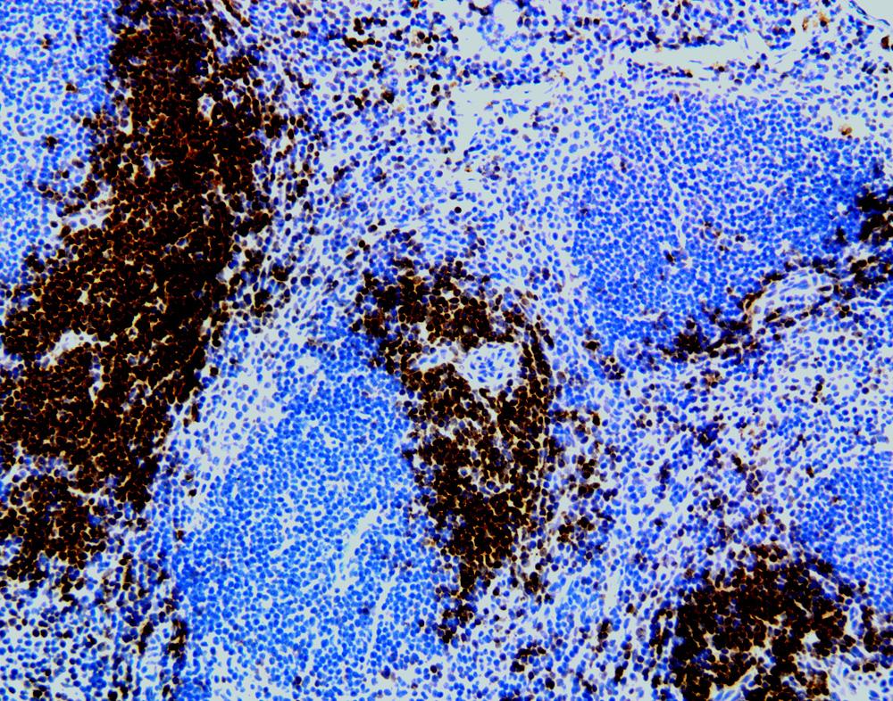 Figure 3. Immunohistochemical staining of CD3 + T lymphocytes. The frozen section of normal mouse spleen was stained with 145-2C11 mab specific for mouse CD3e.