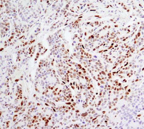 Reagent #8114; right). As shown, polymer-based detection offers enhanced sensitivity and results in more robust staining.
