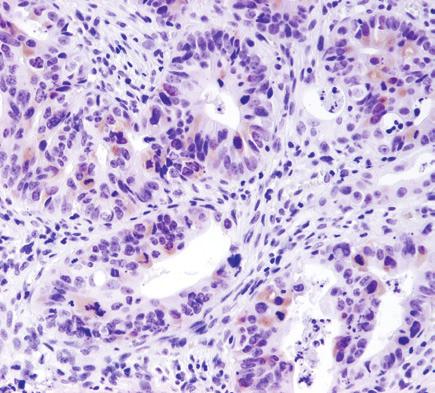 When PLK1 (208G4) Rabbit mab #4513 was first released several years ago, our IHC group could not recommend its use for IHC based on its lack of staining.