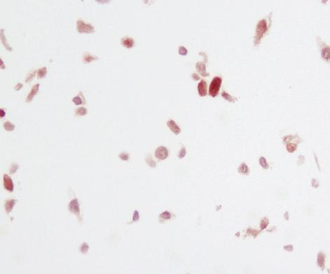 Even though both antibodies adequately stain tissue at their recommended dilutions, the alternate provider s antibody also stains the negative cell pellet.