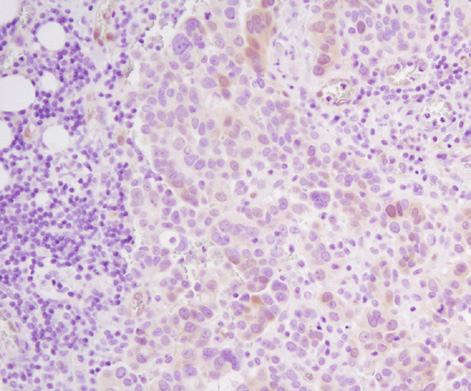 4E) XP Rabbit mab #4370 Specific Signal at CST Determined Optimal Dilution Competitor 1 1:100 Phospho-p44/42 MAPK (Erk1/2) (Thr202/Tyr204) Nonspecific Staining at Provider Recommended Dilution