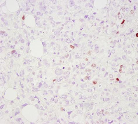 TBST/5% NGS Casein Block For IHC-P, we recommend blocking the samples in Tris buffered saline with Tween 20 (TBST) plus 5% normal goat serum (NGS) for 1 hour at room temperature to prevent