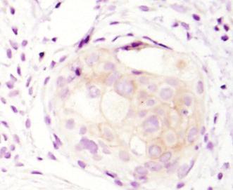 When performing IHC-F, the primary antibody should be diluted in blocking buffer (TBS/0.3% Triton X-100/5% NGS).
