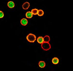 Developmental Immunology PIDDosome Golgi Nucleus DNA-damage ER p53 ATM/ATR Chk1 Heat-shock Caspase-2 Amplification Loop? Caspase-3 Apoptosis BID tbid Mitochondrium Caspase-9 Fig.