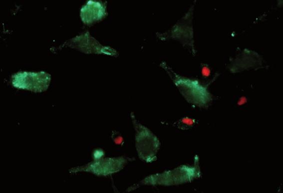 Live/Dead Cell Staining Kits Monitoring of viable and dead cells Cell counting by fluorescence microscopy Excitation and emission spectra are compatible with common excitation sources and filter sets
