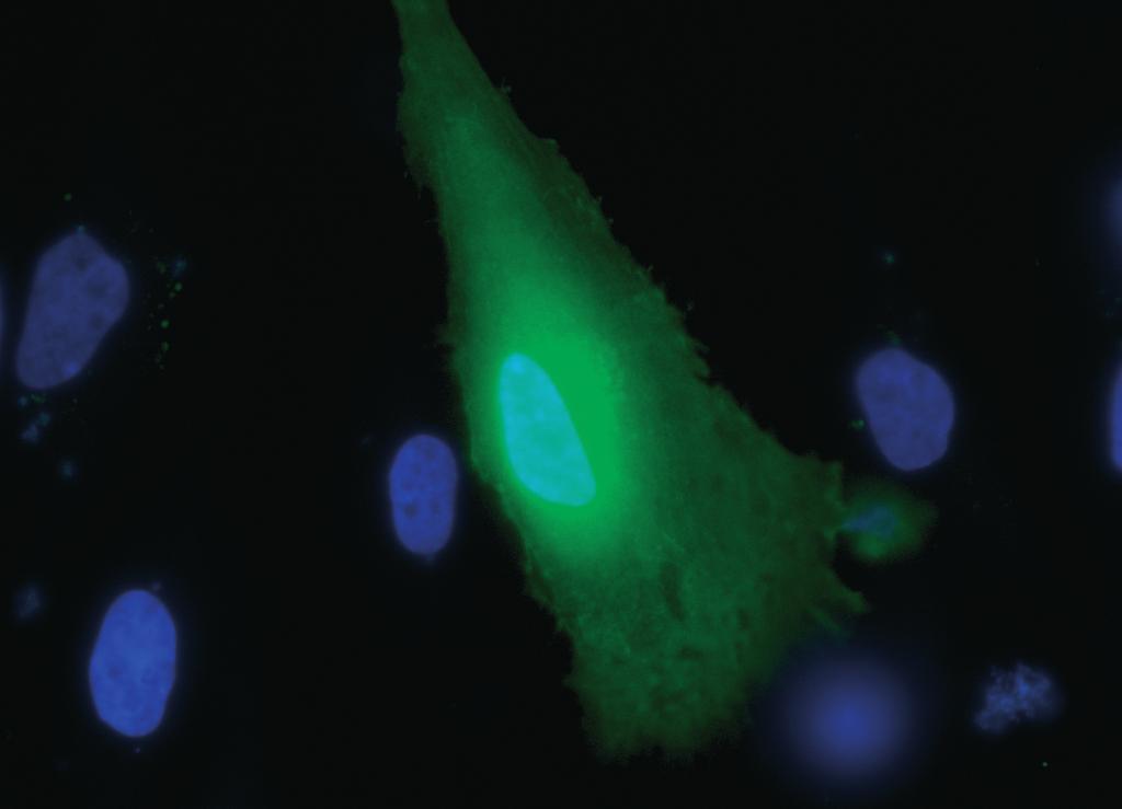 Cell Staining Reagents Staining of viable and dead cells Detection of cellular structures Fluorescence microscopy/flow cytometry Thoroughly tested and highly sensitive PromoKine provides a wide range