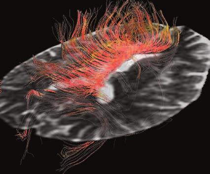 Image gallery Spine, Body, & Vascular Neuro