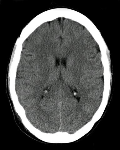 MRI v CT