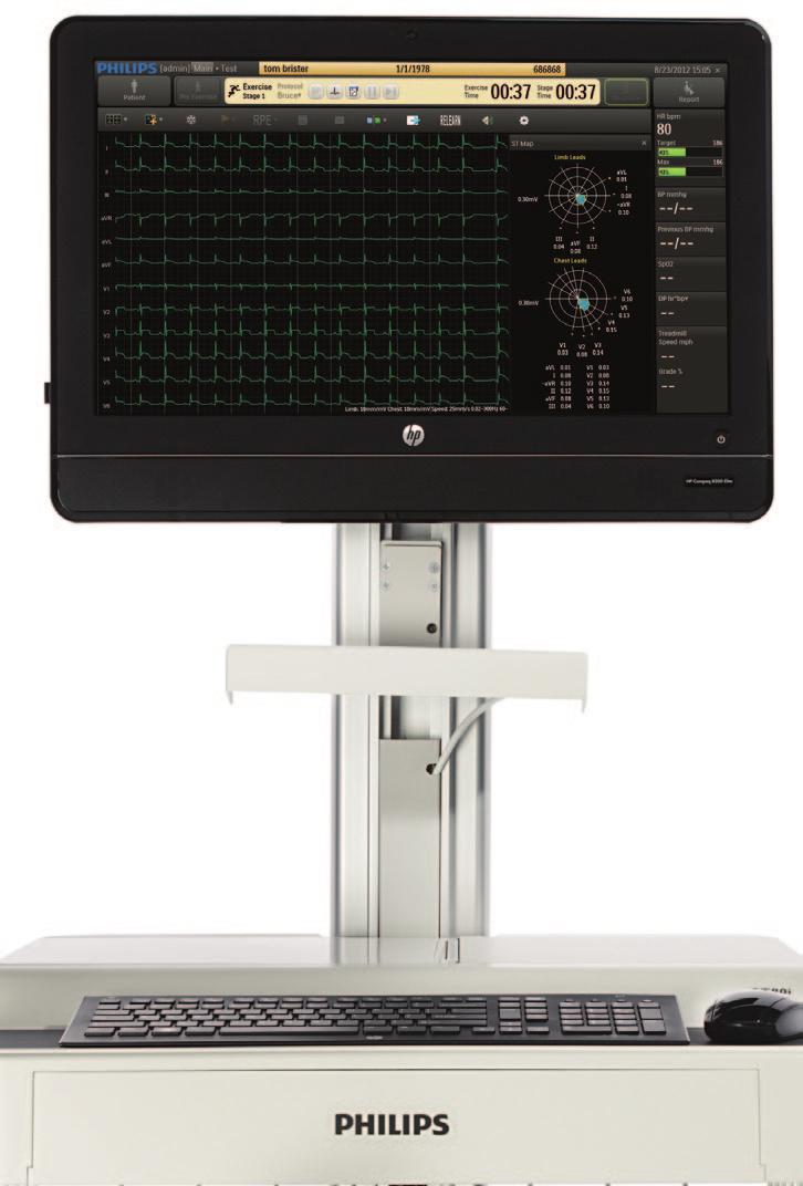 Advanced analytical methods Philips ST80i features tools to help clinicians analyze stress ECG information.