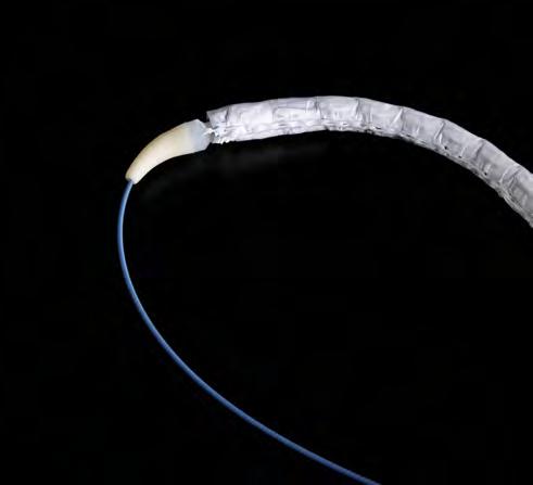 rupture with multiple sheath insertions Sheathless Delivery Catheter