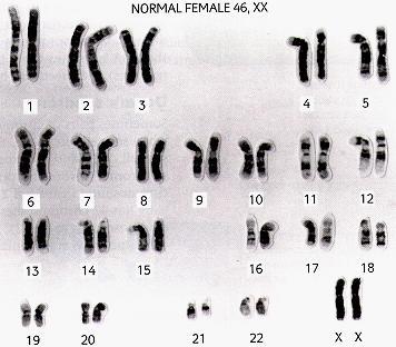 chromosomes f) the synthesis of mrna from DNA.