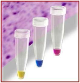 CyDye DIGE Fluor dyes Minimal labelling dyes Label 50 µg of protein 3 colors: Cy 2, Cy3, Cy5 MW matched (~450Da)