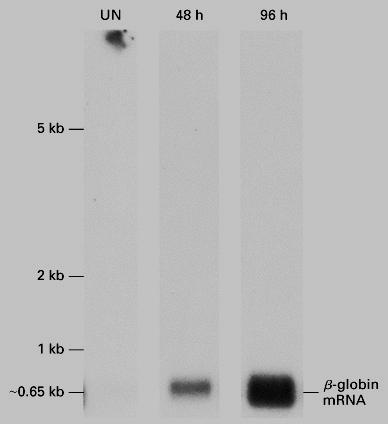 7.5 Northern blotting detects specific mrnas Figure 7-33 Western Blot - your protein Separation on gel a protein