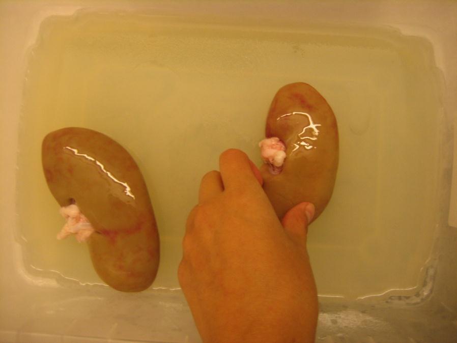 kidneys on an agar layer.