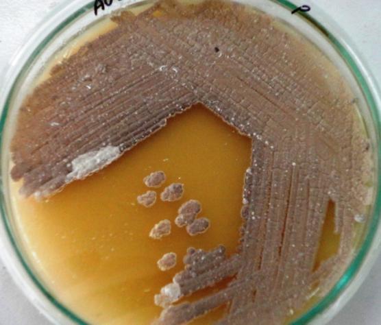 1: Actinomycetes isolation agar plate showing growth of actinomycete colonies