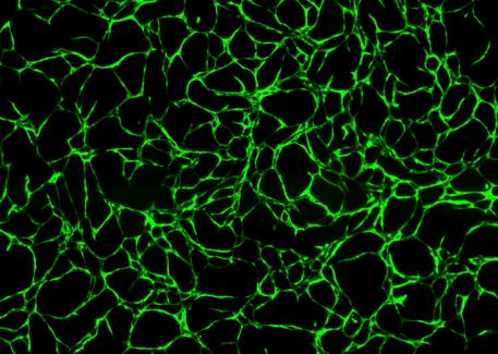Angiogenesis ADSC/ECFC Cord Formation Essen BioScience