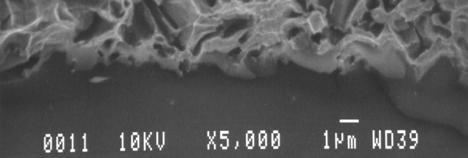 We have analyzed the microstructure of both quenched and slowly-cooled Au-Si eutectic, and observed that the quenched eutectic has a finer microstructure.