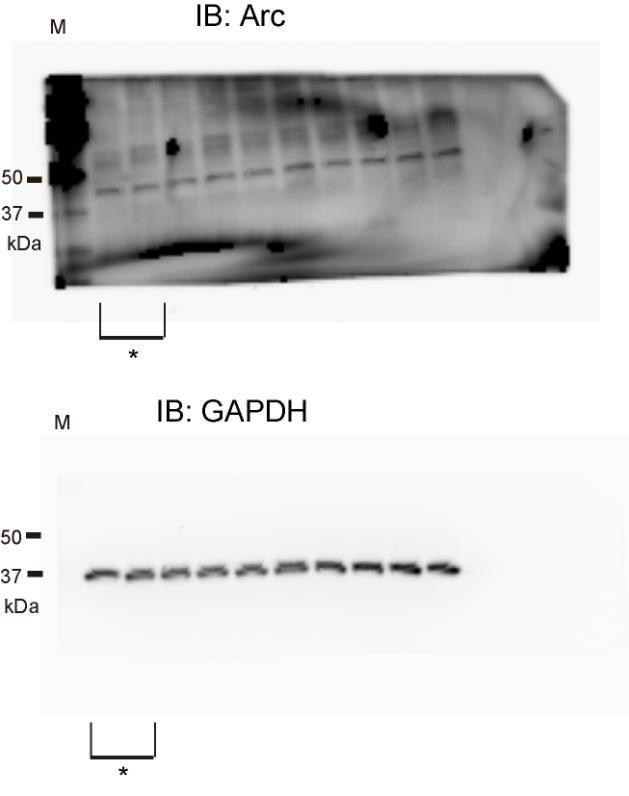 Supplementary Figure 12 Full-length of western blot by anti-arc and anti-gapdh antibodies.