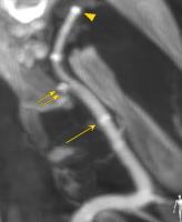 Evaluation IRB Approved 57 CBCT