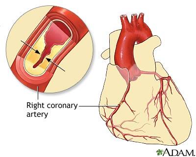 It can provide not only anatomy of heart including heart chambers and coronary arteries (Fig.2), but also clinical information such as calcification, plaque composition and stenosis etc.
