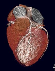 Section: Vascular and Molecular Imaging Available masters project: Matching 3D Coronary Centerlines on 2D X-ray Images Introduction The coronary arteries provide the human hearth with oxygen rich