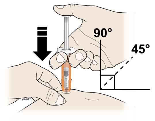 Step 3: Subcutaneous (under the skin) injection I Pinch your injection site to create a firm surface. Important: Keep skin pinched while injecting.