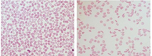 blood cells b.