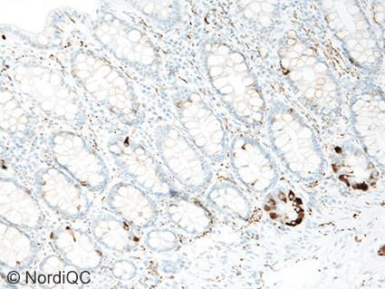 In this run, and in protocols assessed as optimal, only scattered goblet cells displayed this staining pattern. No staining must be seen in smooth muscle cells.