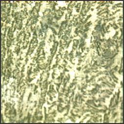 Fig.6.11 Micrograph at 2.15 KJ/mm heat-input using parent acidic flux: -acicular ferrite, GBF-grain boundary ferrite, -polygonal ferrite.
