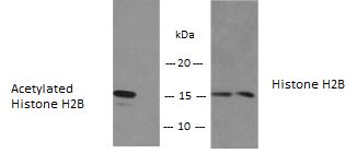 DATA ANALYSIS 12. TYPICAL DATA ab138916 Histone H2B Acetyl (K5) ELISA Kit detects levels of acetylated lysine (K5) on Histone H2B.